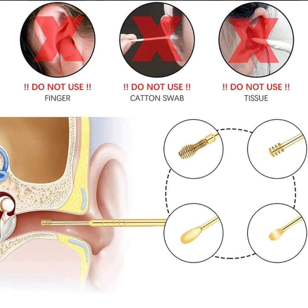 6 Pcs Ear Wax Removal Kit – Stainless Steel Ear Cleaner Tools with Bright Yellow Travel Case | Safe, Reusable & Comfortable